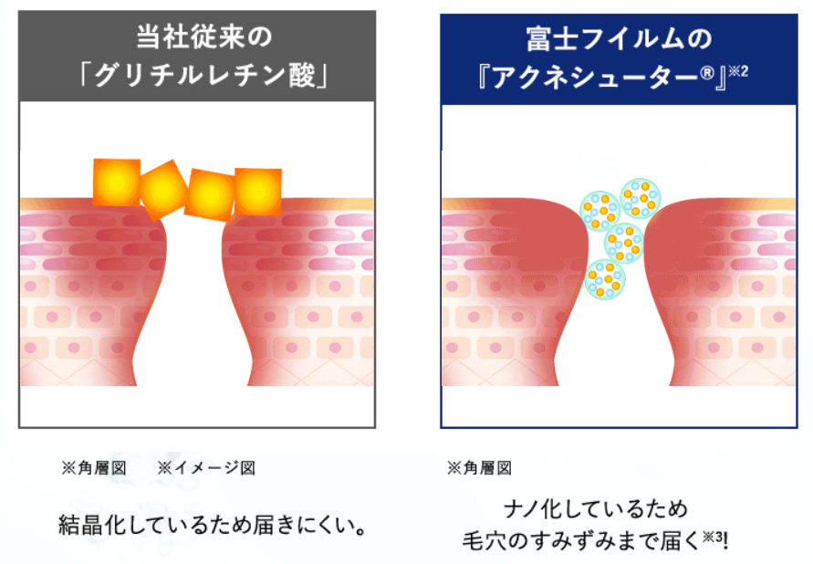 大人ニキビ対策 大人気ルナメアacの効果と成分を徹底レビュー Smilechoice